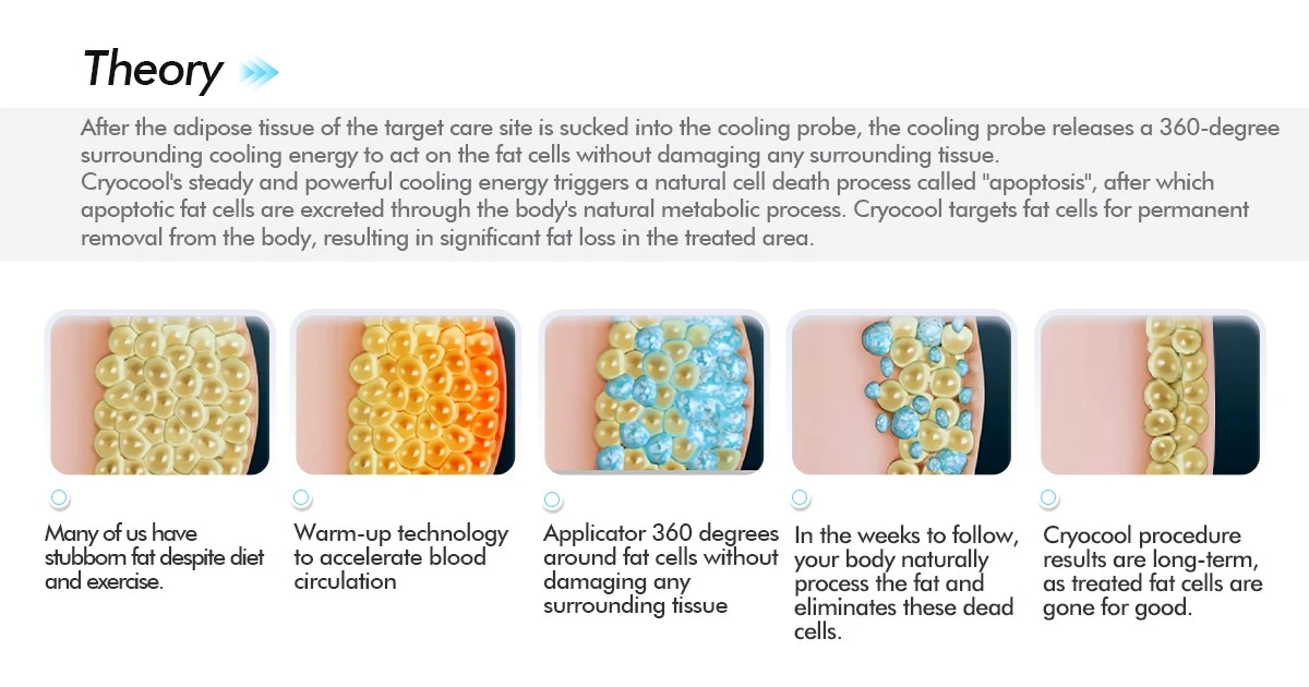 cryolipolysis slimming machine cryolipolysis slimming machine